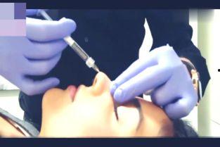 耳鸣一针特效视频,揭秘神奇治愈瞬间